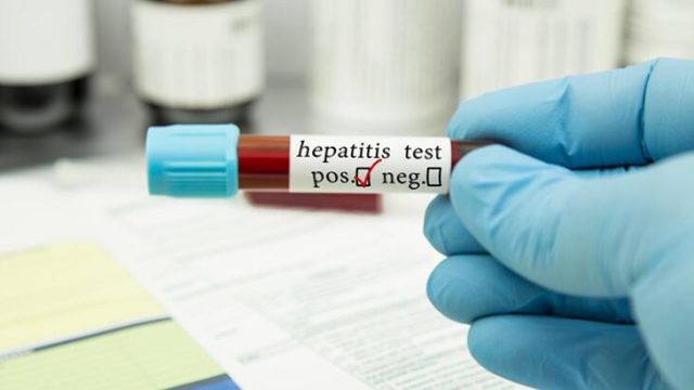 Viral hepatitler ve korunma yollarına dikkat